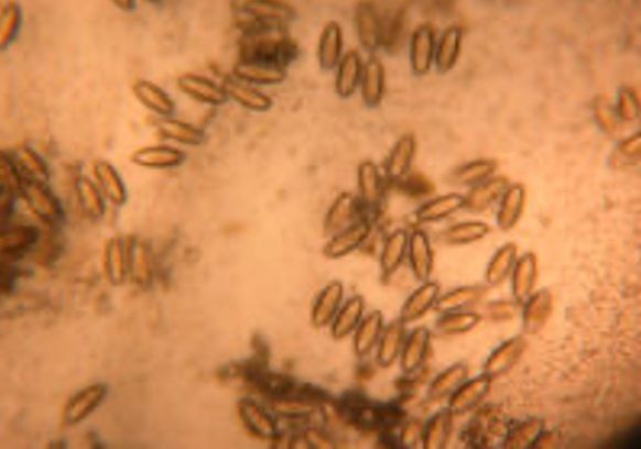 Eggs under the microscope